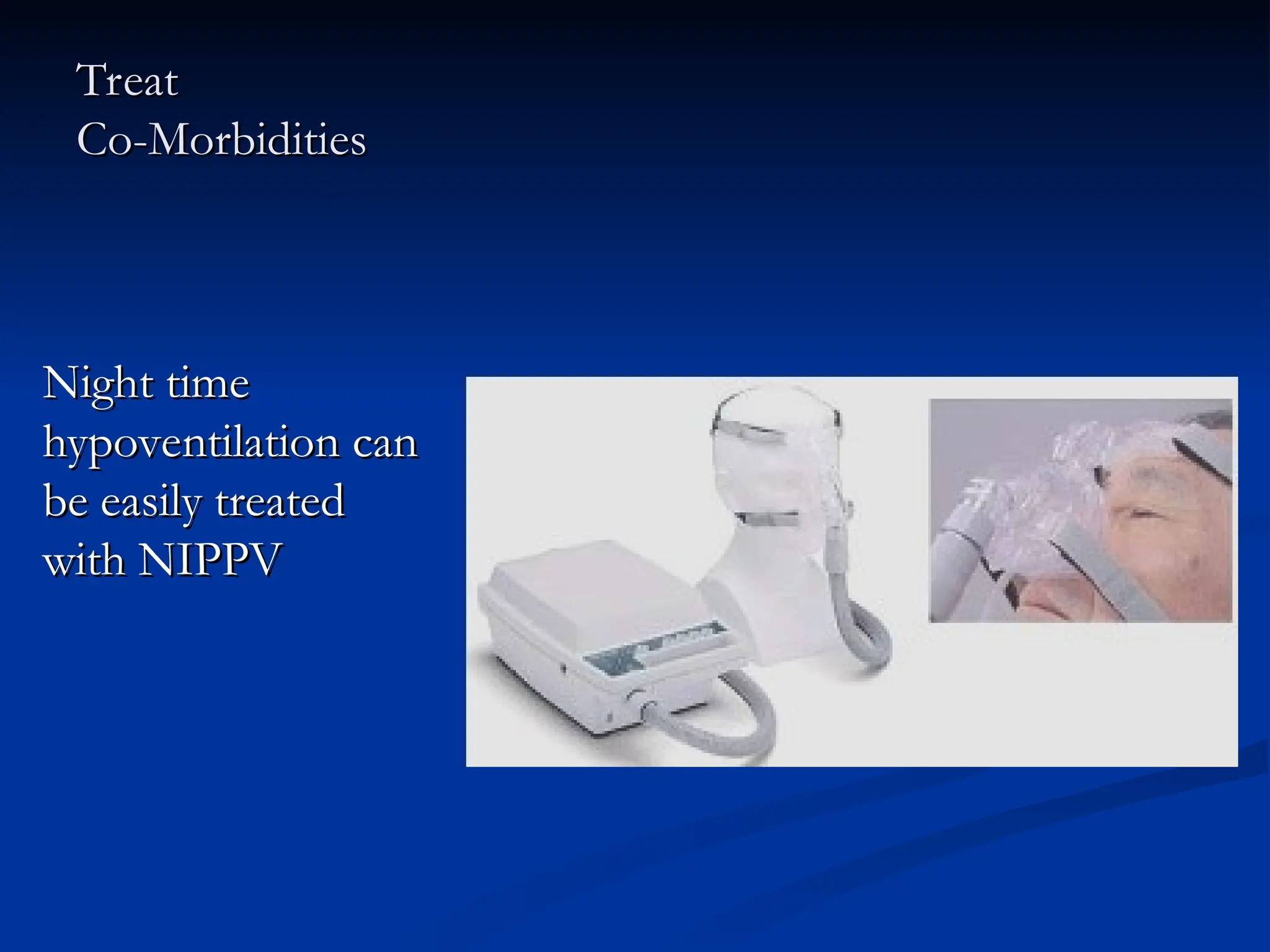 Treat
Treat
Co-Morbidities
Co-Morbidities
Night time
Night time
hypoventilation can
hypoventilation can
be easily treated
be easily treated
with NIPPV
with NIPPV
 