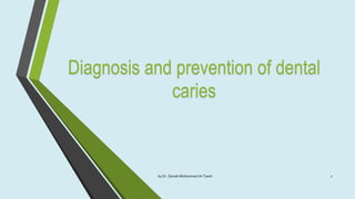 Diagnosis and prevention of dental
caries
by Dr. Zainab Mohammed Al-Tawili 1
 