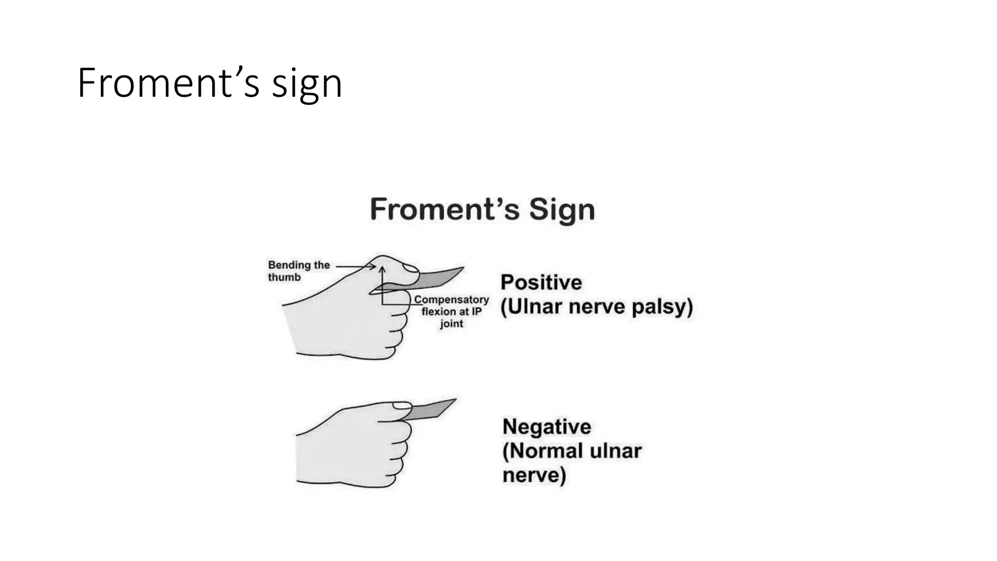 Diagnosis and principles of management of radial^J.pptx