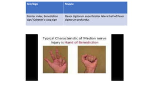 Diagnosis and principles of management of radial^J.pptx