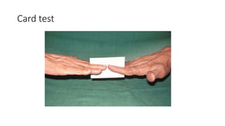 Jrt Test Card Diagnosis and principles of management of radial^J.pptx