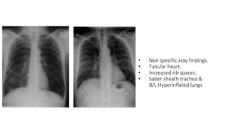 DIAGNOSIS AND TREATMENT OF COPD.pptx