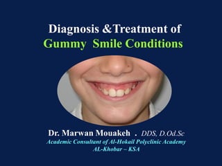 Diagnosis &Treatment of
Gummy Smile Conditions

Dr. Marwan Mouakeh . DDS, D.Od.Sc
Academic Consultant of Al-Hokail Polyclinic Academy
AL-Khobar – KSA

 