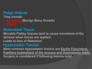 Flaring Ridge Defect Diagnosis and treatment planning | PPTX