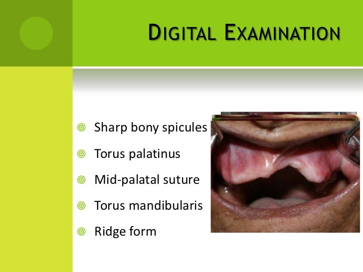 Diagnosis and treatment planning in complete dentures