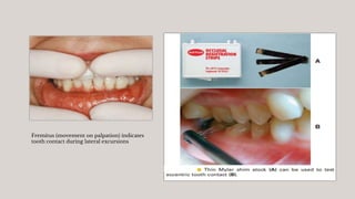 Diagnosis And Treatment Planning in Fixed Prosthodontics.pptx