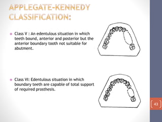 Diagnosis and treatment planning in rpd | PPTX