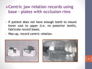 Occlusal Record Rpd Diagnosis and treatment planning in rpd | PPTX