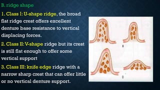 Segmented Ridge Shape diagnosis and treatment planning of C.D.pptx