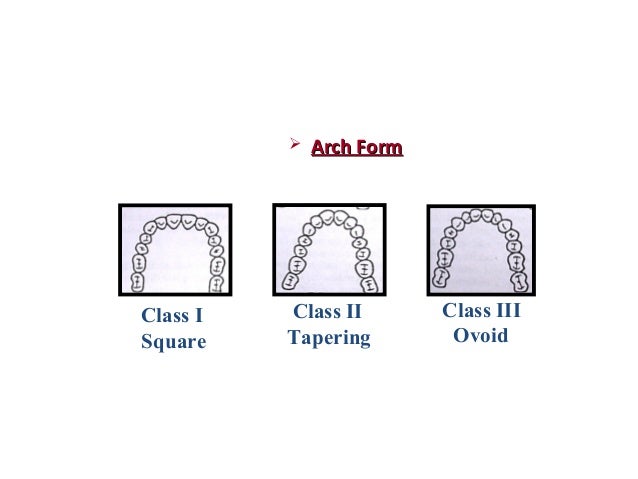 classification of edentulous ridge