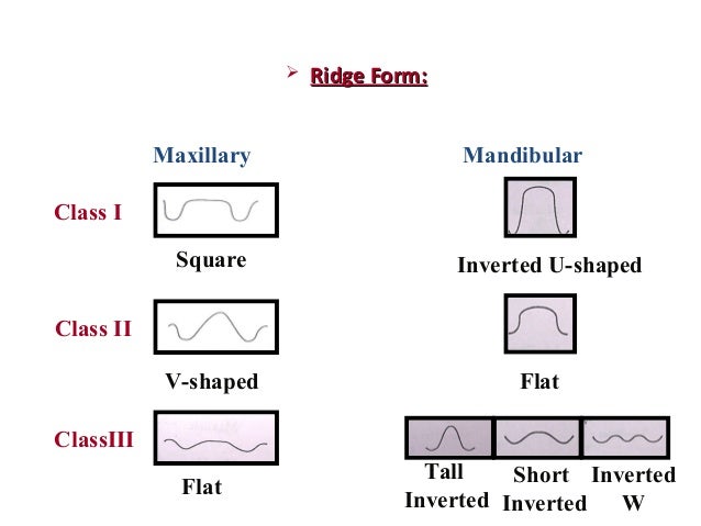 classification of edentulous ridge