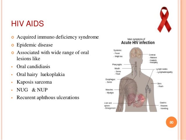 an analysis of acquired immune deficiency syndrome aids in west Impact of acquired immune deficiency syndrome in africa the impact of aids in southern africa has been devastating some communities have been very hard hit with many deaths and economic hardship related to loss of the workforce of young adults however, significant progress has been made in the last decade. an analysis of acquired immune deficiency syndrome aids in west Impact of acquired immune deficiency syndrome in africa the impact of aids in southern africa has been devastating some communities have been very hard hit with many deaths and economic hardship related to loss of the workforce of young adults however, significant progress has been made in the last decade.