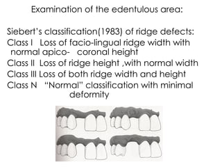 Siberet Ridge Defect diagnosis and tt planning. in prosthodontics | PPTX