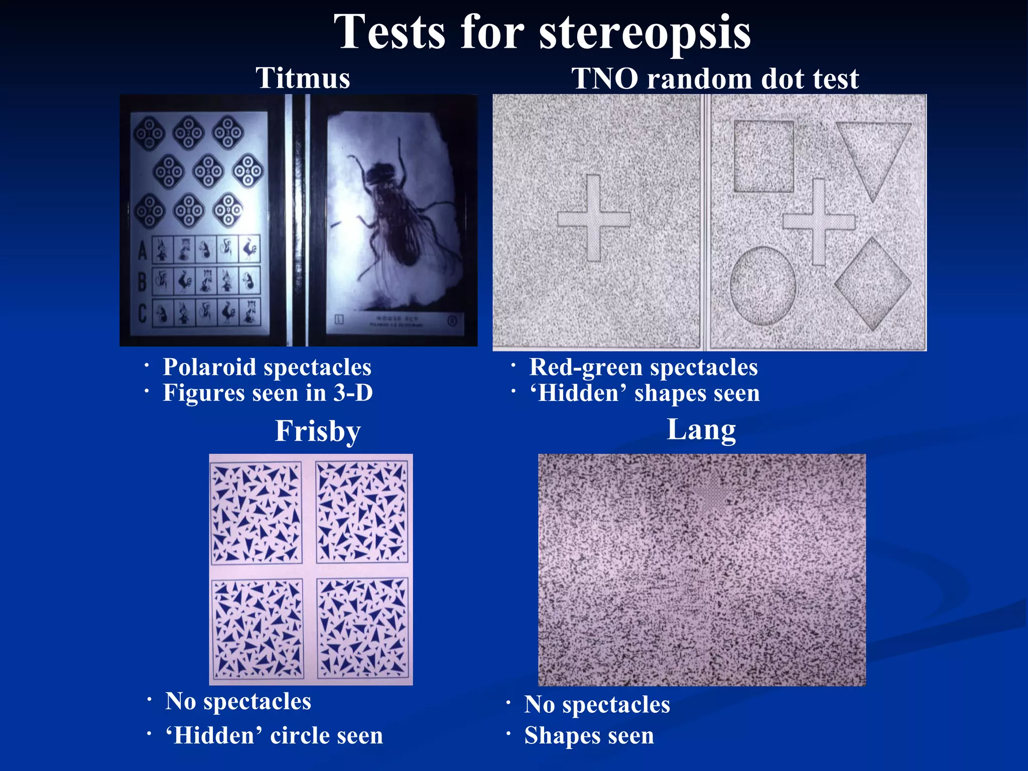 Tests for stereopsis Titmus Red-green spectacles TNO random dot test ‘ Hidden’ shapes seen  Polaroid spectacles Figures seen in 3-D Lang No spectacles Frisby ‘ Hidden’ circle seen No spectacles Shapes seen 