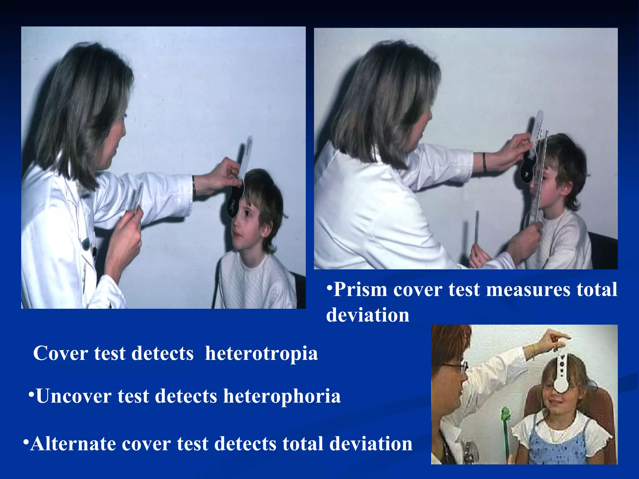 Cover test detects  heterotropia Uncover test detects heterophoria   Alternate cover test detects total deviation Prism cover test measures total deviation 