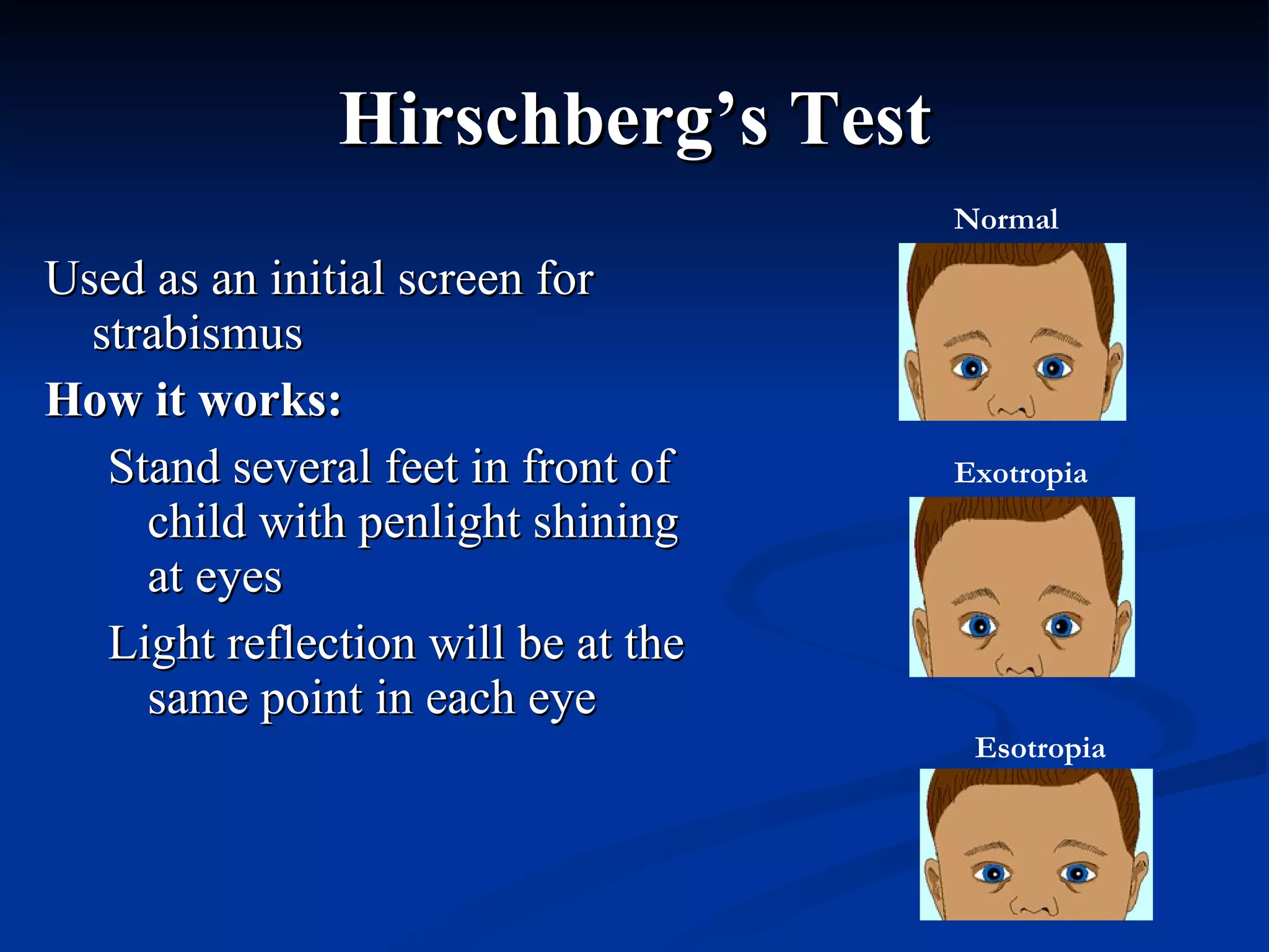 Hirschberg’s Test Used as an initial screen for strabismus How it works: Stand several feet in front of child with penlight shining at eyes Light reflection will be at the same point in each eye Normal Exotropia Esotropia 