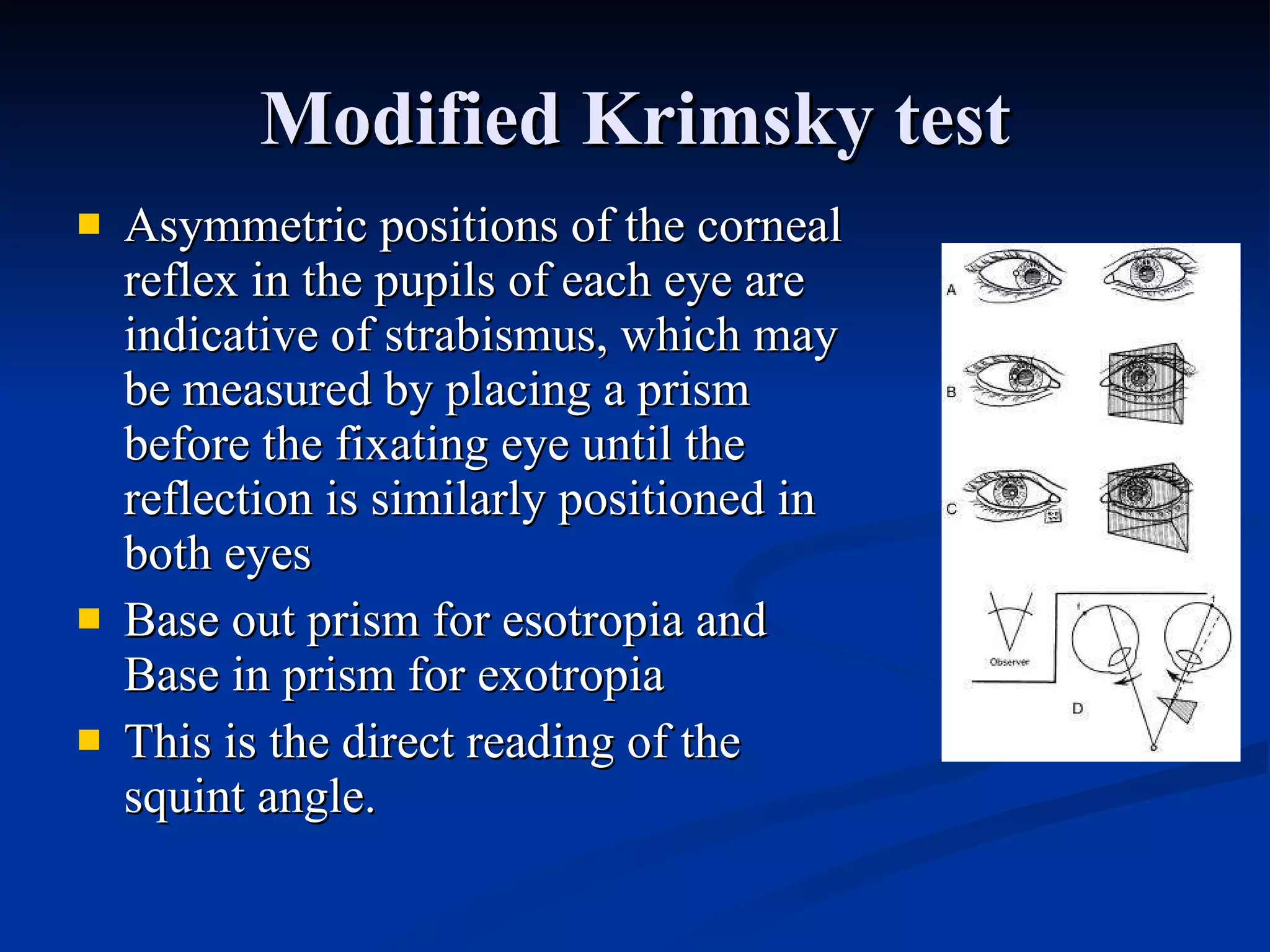 Modified Krimsky test Asymmetric positions of the corneal reflex in the pupils of each eye are indicative of strabismus, which may be measured by placing a prism before the fixating eye until the reflection is similarly positioned in both eyes Base out prism for esotropia and Base in prism for exotropia This is the direct reading of the squint angle. 