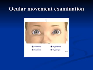 Ocular movement examination 