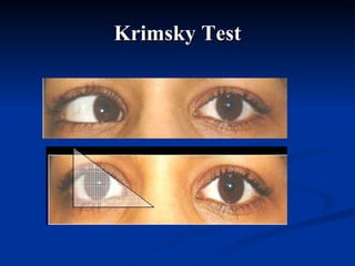Krimsky Test 