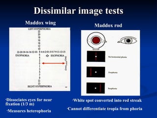 Dissimilar image tests Maddox wing Maddox rod Dissociates eyes for near fixation (1/3 m) Measures heterophoria White spot converted into red streak Cannot differentiate tropia from phoria 