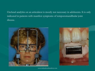 Occlusal analylsis on an articulator is mostly not necessary in adolscents. It is only
indicated in patients with manifest symptoms of temporomandibular joint
disease.

www.indiandentalacademy.com

 