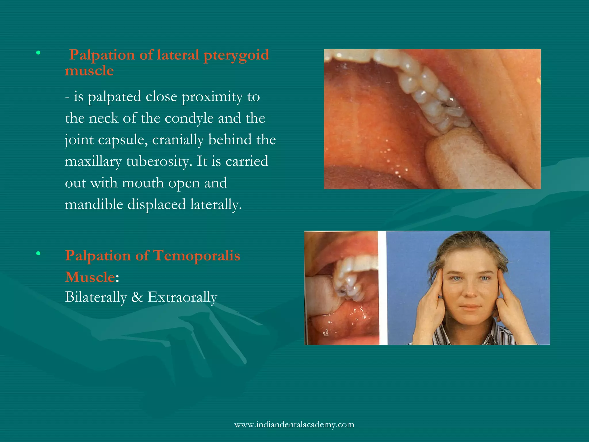 • Palpation of lateral pterygoid
muscle
- is palpated close proximity to
the neck of the condyle and the
joint capsule, cranially behind the
maxillary tuberosity. It is carried
out with mouth open and
mandible displaced laterally.
• Palpation of Temoporalis
Muscle:
Bilaterally & Extraorally
www.indiandentalacademy.com
 