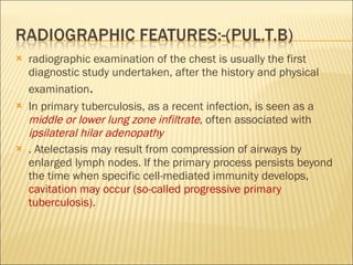 radiographic examination of the chest is usually the first diagnostic study undertaken, after the history and physical examination .  In primary tuberculosis, as a recent infection, is seen as a  middle or lower lung zone infiltrate , often associated with  ipsilateral hilar adenopathy  . Atelectasis may result from compression of airways by enlarged lymph nodes. If the primary process persists beyond the time when specific cell-mediated immunity develops,  cavitation may occur (so-called progressive primary tuberculosis). 