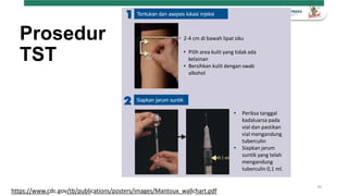 Turapi Rapid Diagnosis ILTB terapi dan monitoring TPT Fix.pptx