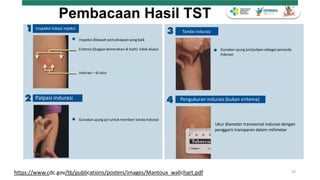 Turapi Rapid Diagnosis ILTB terapi dan monitoring TPT Fix.pptx