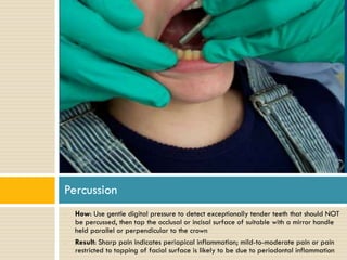 Percussion
•

•

How: Use gentle digital pressure to detect exceptionally tender teeth that should NOT
be percussed, then tap the occlusal or incisal surface of suitable with a mirror handle
held parallel or perpendicular to the crown
Result: Sharp pain indicates periapical inflammation; mild-to-moderate pain or pain
restricted to tapping of facial surface is likely to be due to periodontal inflammation

 