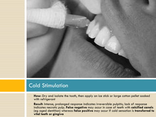Cold Stimulation
•

•

How: Dry and isolate the tooth, then apply an ice stick or large cotton pellet soaked
with refrigerant
Result: Intense, prolonged response indicates irreversible pulpitis; lack of response
indicates necrotic pulp. False negative may occur in case of teeth with calcified canals
(eg aged dentition) whereas false positive may occur if cold sensation is transferred to
vital teeth or gingiva

 