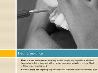 Heat Stimulation
•

•

How: It is best and safest to use a dry rubber prophy cup to produce frictional
heat, after isolating the tooth with a rubber dam; alternatively, a syringe filled
with hot water may be used
Result: A sharp non-lingering response indicates vital (not necessarily normal) pulp

 