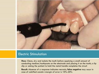Electric Stimulation
•

•

How: Clean, dry and isolate the tooth before applying a small amount of
conducting medium/toothpaste on the electrode and placing it on the tooth; a lip
clip or asking the patient to hold the metal handle completes the circuit
Result: Absence of a response indicates necrosis; false negative may occur in
case of calcified canals—margin of error is 10%-20%

 
