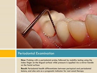 Periodontal Examination
•

•

How: Probing with a periodontal probe, followed by mobility testing using the
index finger on the lingual surface while pressure is applied via a mirror handle
on the facial surface
Result: Periodontal health differentiates between periapical and periodontal
lesions, and also acts as a prognostic indicator for root canal therapy

 