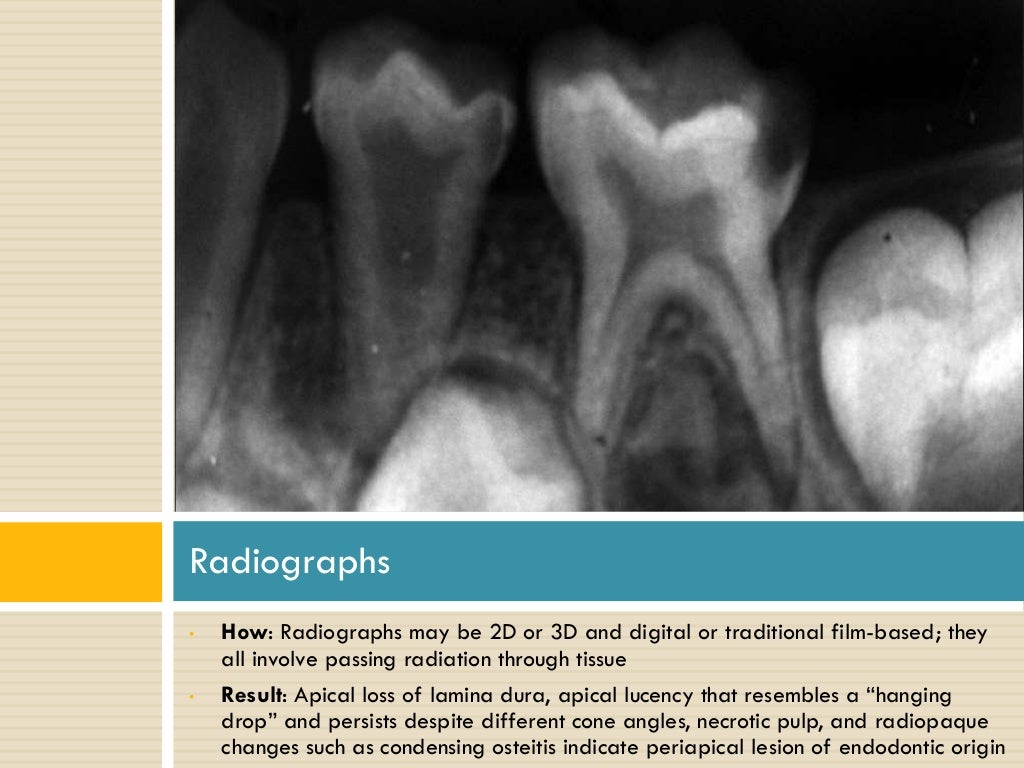 Diagnosis in Endodontics
