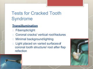 Tests for Cracked Tooth
Syndrome
Transillumination
Fiberopticlight
Coronal cracks/ vertical rootfractures
Minimal backgroundlighting
Light placed on varied surfacesof
coronal tooth structure/ root after flap
refection
 