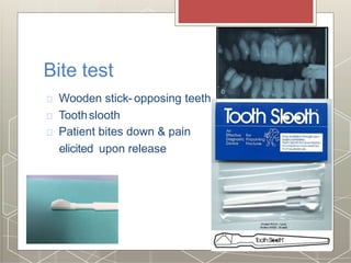 Bite test
Wooden stick-opposing teeth
Toothslooth
Patient bites down & pain
elicited upon release
 