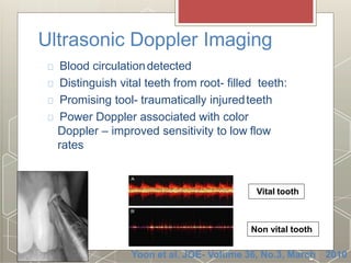 Ultrasonic Doppler Imaging
Blood circulationdetected
Distinguish vital teeth from root- filled teeth:
Promising tool- traumatically injuredteeth
Power Doppler associated with color
Doppler – improved sensitivity to low flow
rates
Non vital tooth
Yoon et al. JOE- Volume 36, No.3, March 2010
Vital tooth
 