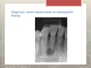 Diagnosis: never based solely on radiographic
finding
 