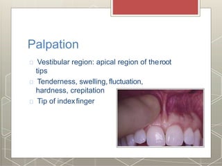 Palpation
Vestibular region: apical region of theroot
tips
Tenderness, swelling, fluctuation,
hardness, crepitation
Tip of indexfinger
 