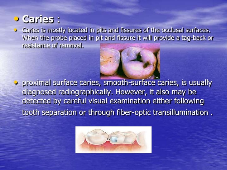 Diagnosis in operative dentistry