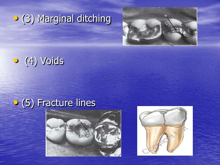 Diagnosis in operative dentistry