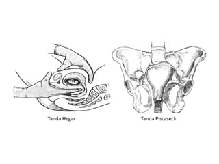 Tanda Hegar Tanda Piscaseck
 