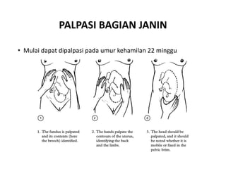 PALPASI BAGIAN JANIN
• Mulai dapat dipalpasi pada umur kehamilan 22 minggu
 
