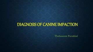 DIAGNOSIS OF CANINE IMPACTION
Thabassum Parakkal
 