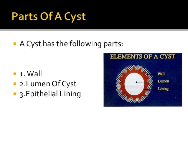 Diagnosis of cysts in oral cavity Diagnosis of cysts in oral cavity