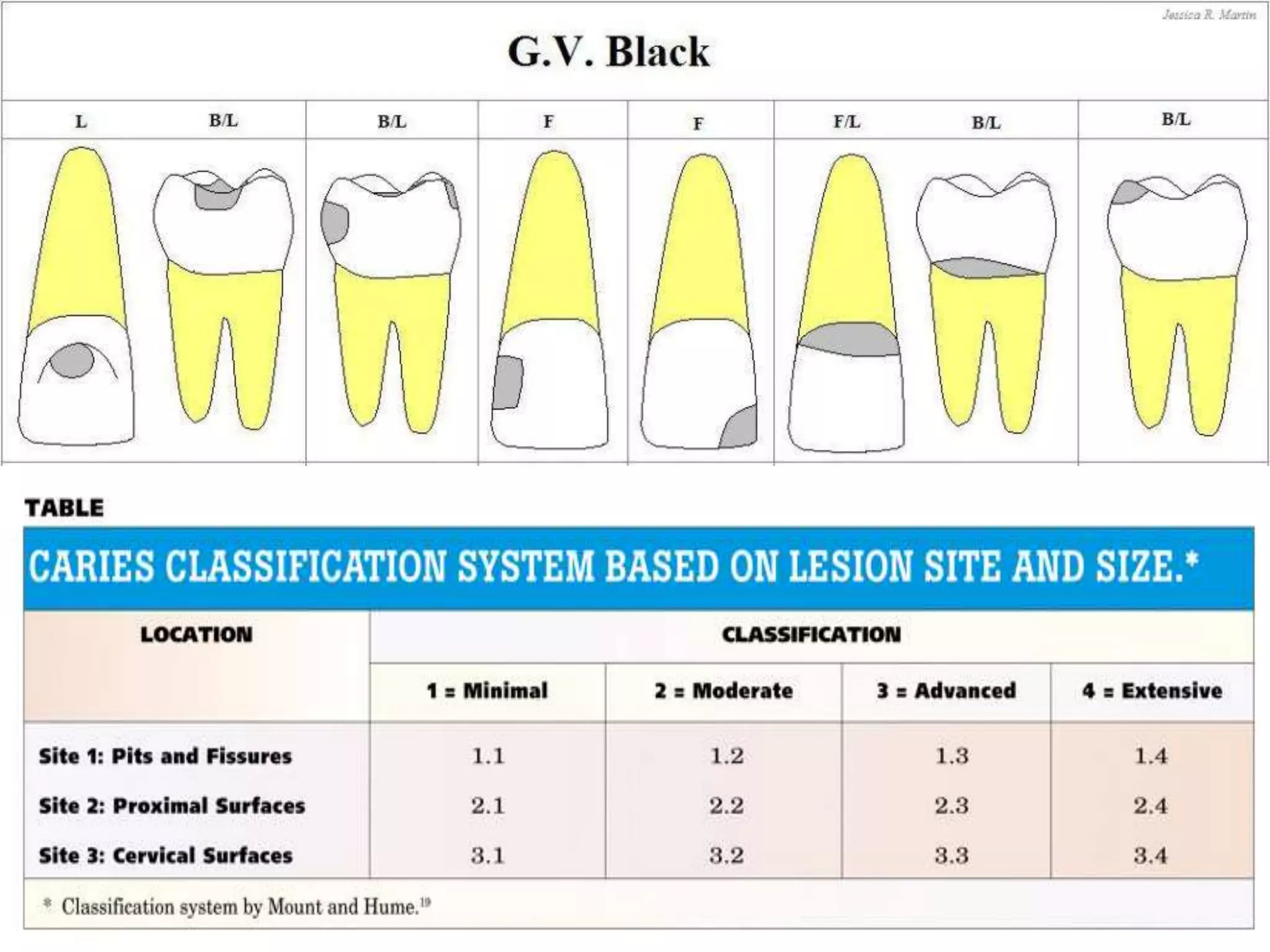 Diagnosis of dental caries | PPTX