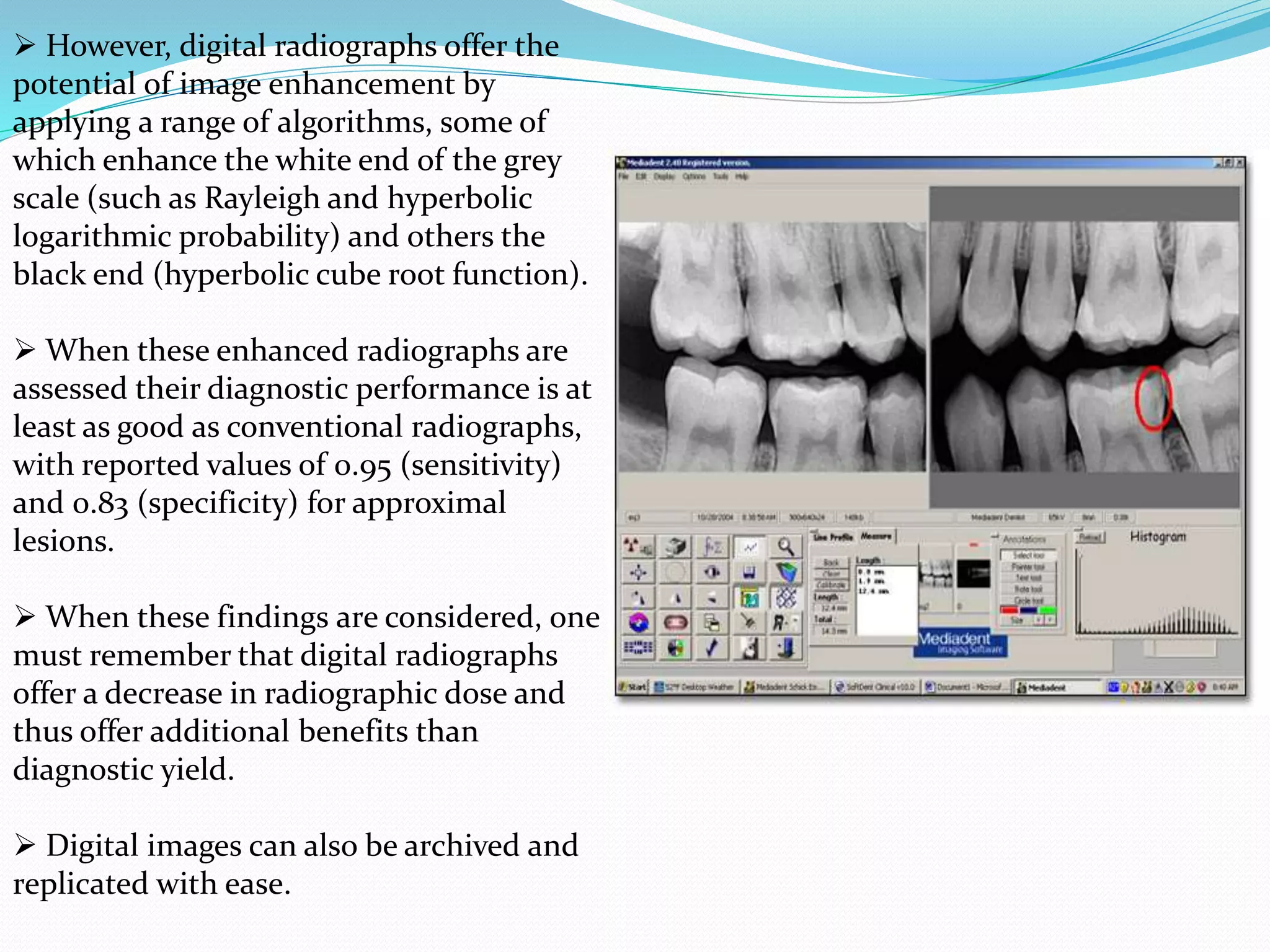 Diagnosis of dental caries