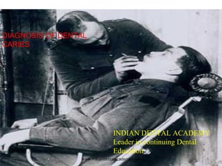 www.indiandentalacademy.com
DIAGNOSIS OF DENTAL
CARIES
INDIAN DENTAL ACADEMY
Leader in continuing Dental
Education
 