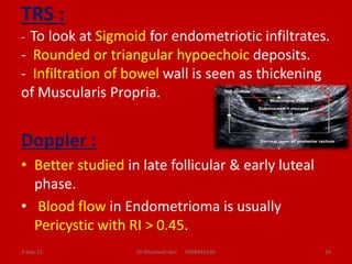 TRS :
- To look at Sigmoid for endometriotic infiltrates.
- Rounded or triangular hypoechoic deposits.
- Infiltration of b...